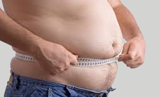 Obesity