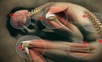 Rheumatological Diseases